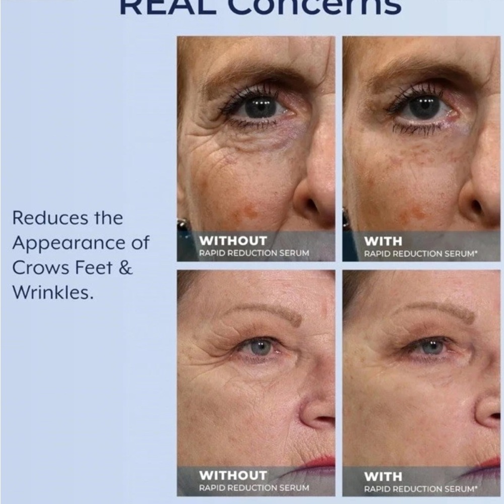 Plexaderm Rapid Reduction Serum under eye bags and wrinkles - Picture 6 of 6